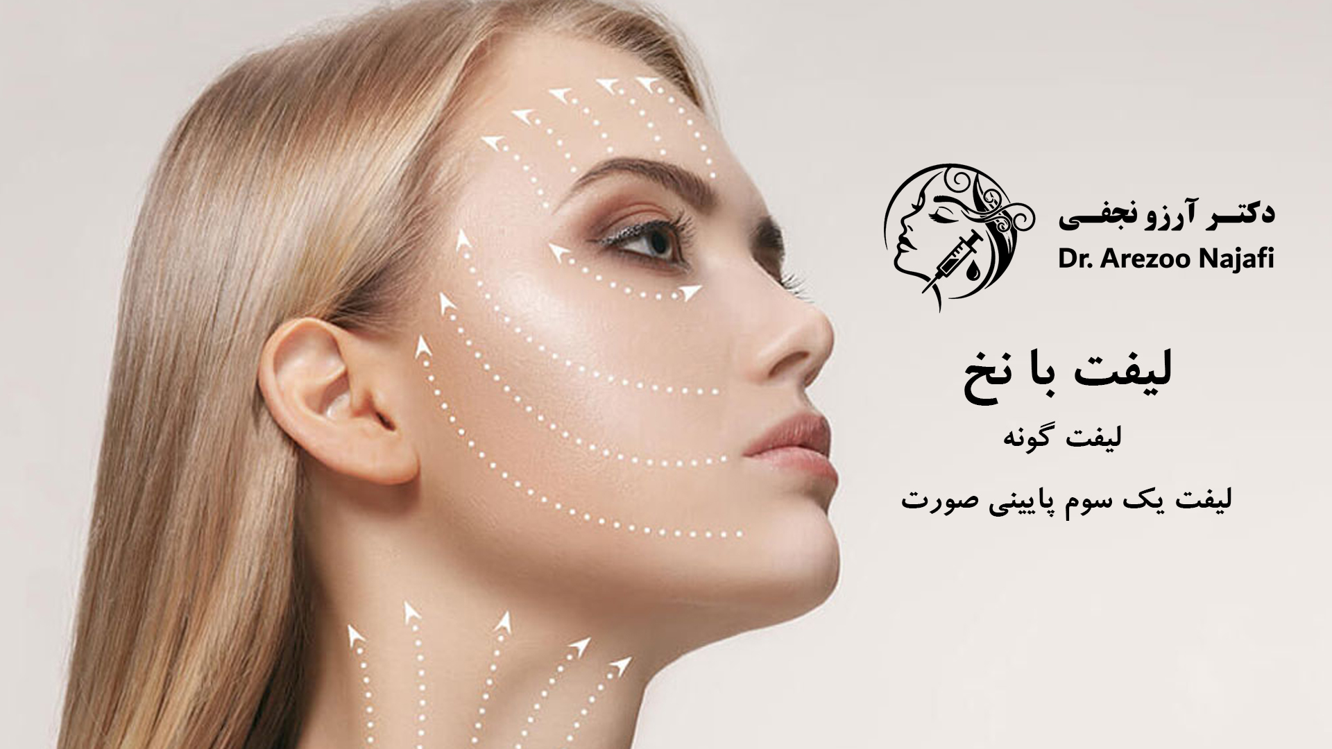 اسلاید-لیفت-دکتر-آرزو-نجفی
